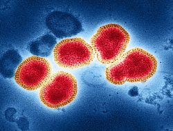 Virus Nipah Mengancam Asia, Seberapa Berbahaya?